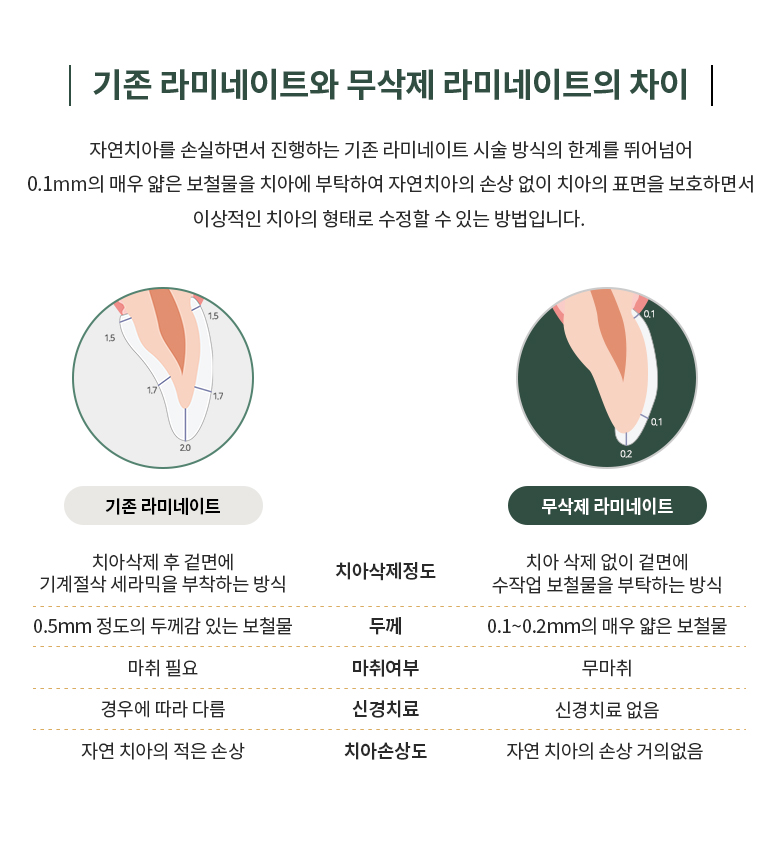 무삭제 라미네이트 이미지3