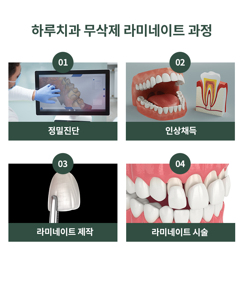 무삭제 라미네이트 이미지5