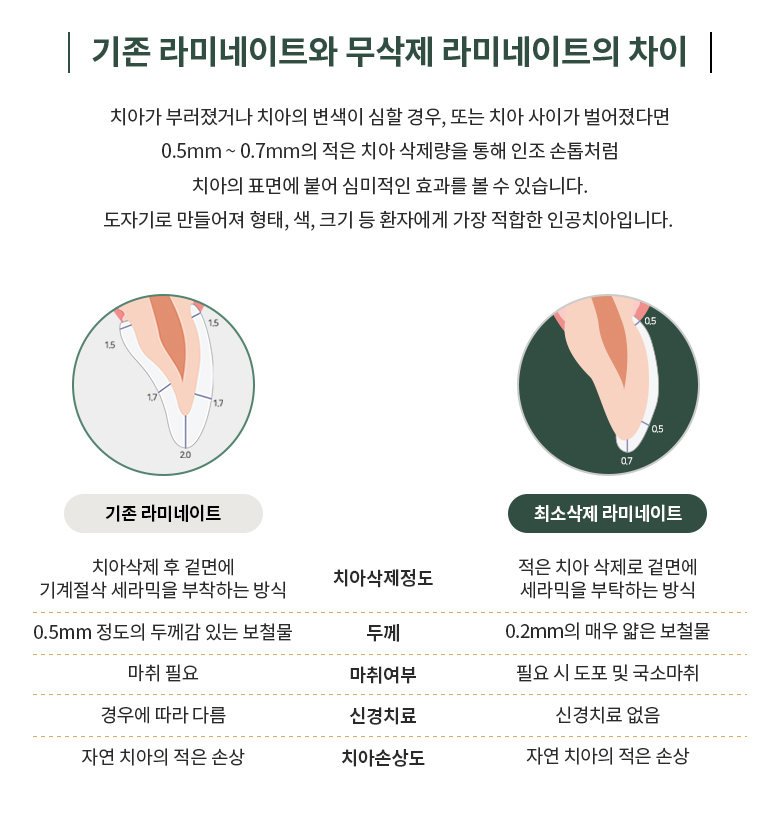 최소삭제 라미네이트 이미지3