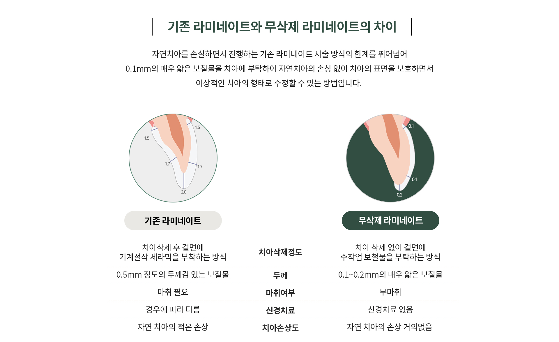 무삭제 라미네이트 이미지3